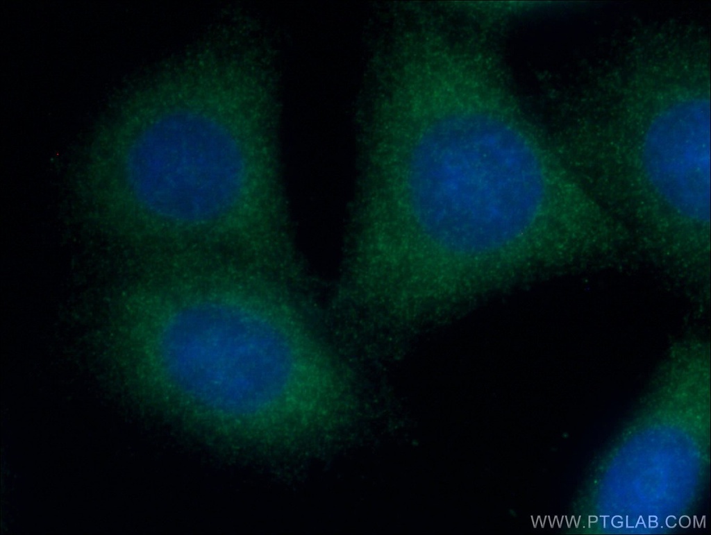 OPTN Monoclonal antibody