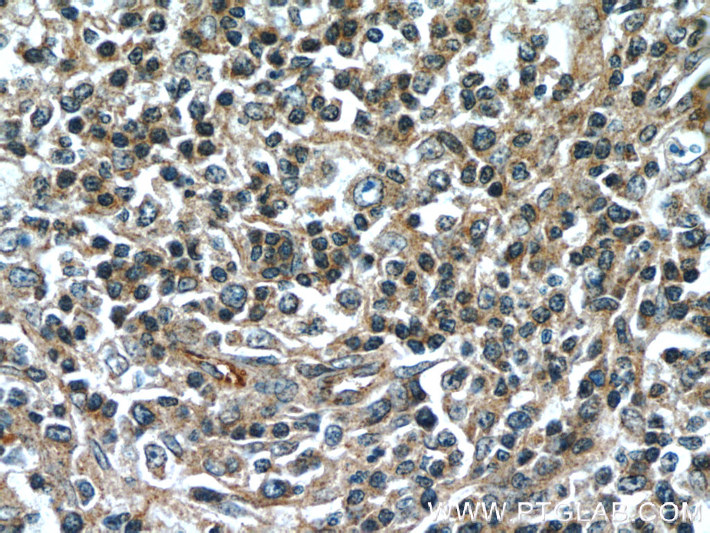 SCGF Monoclonal antibody