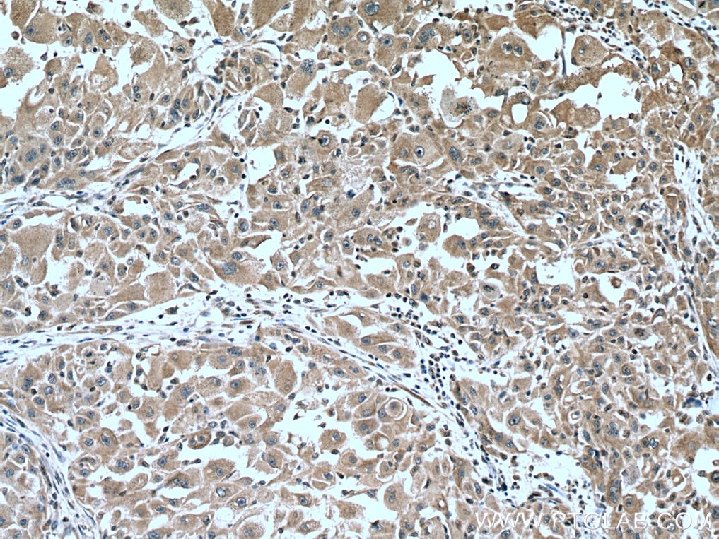 CYP2D6 Monoclonal antibody