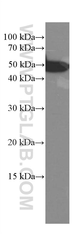 CREST Monoclonal antibody