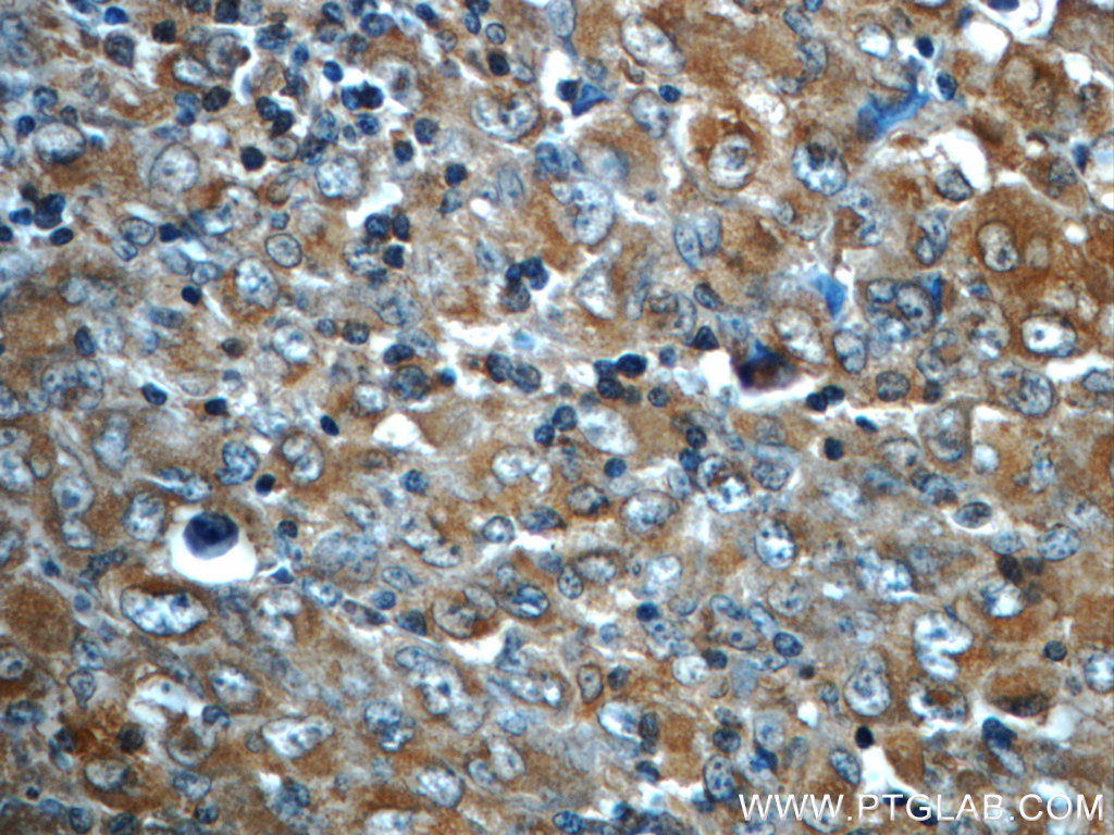 ALK/CD246 Monoclonal antibody
