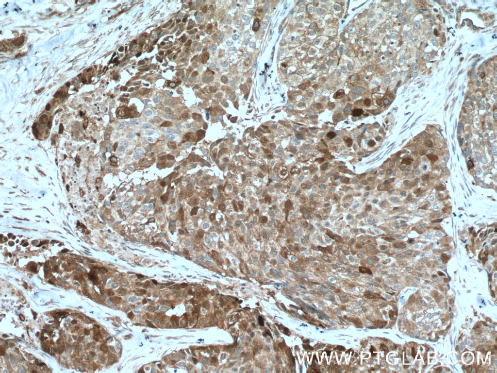 TNFAIP1 Monoclonal antibody