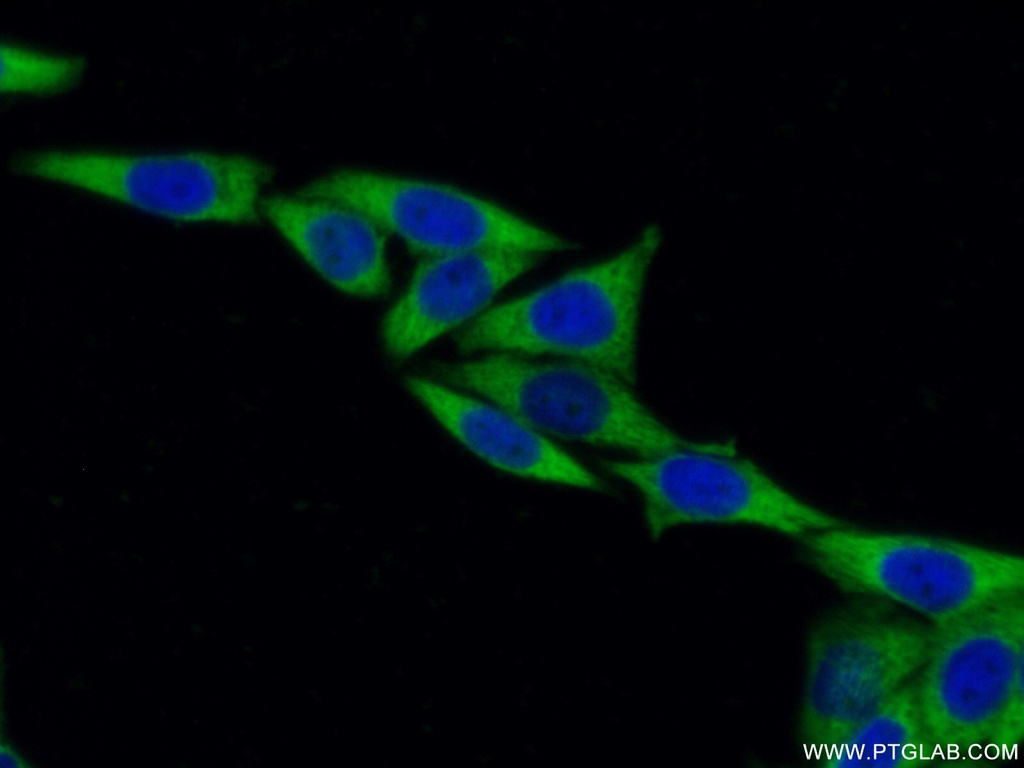 EEF1B2 Monoclonal antibody