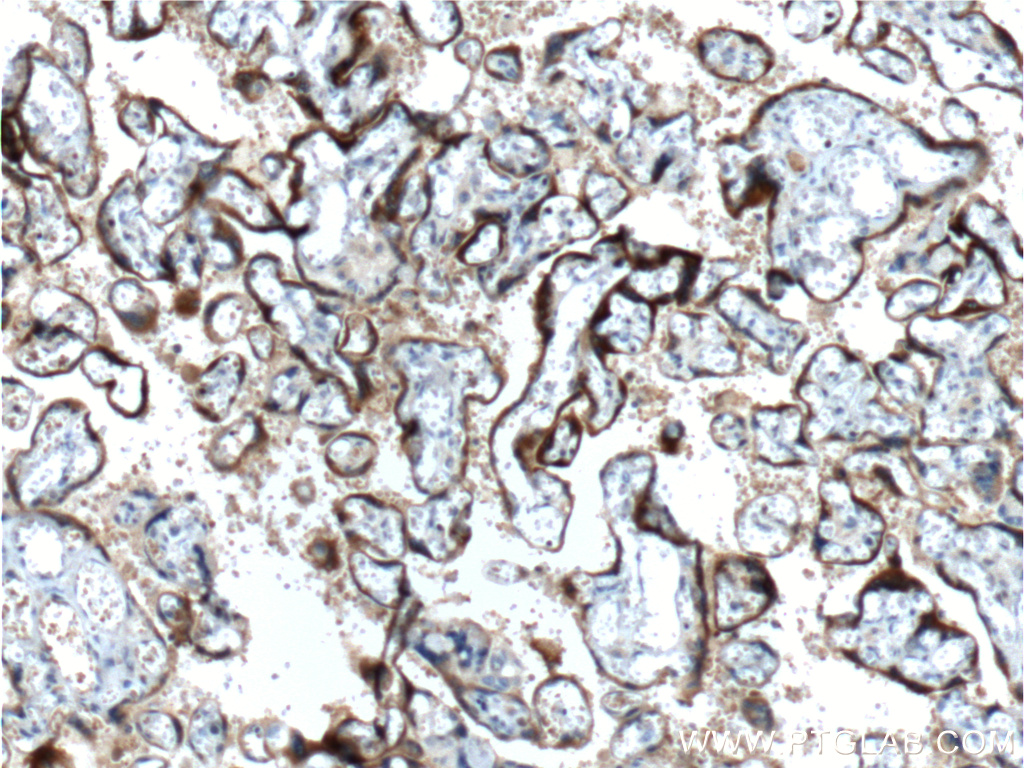 hCG Beta Monoclonal antibody