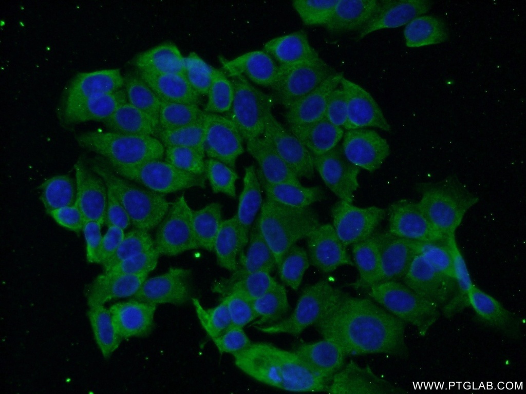 DBC1 Monoclonal antibody