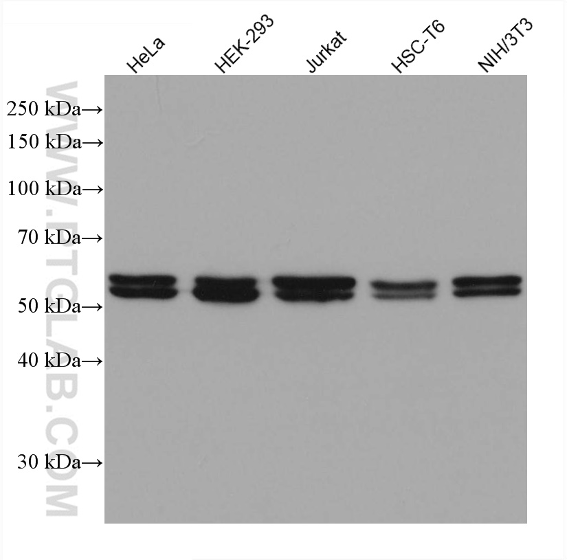 HEXA Monoclonal antibody