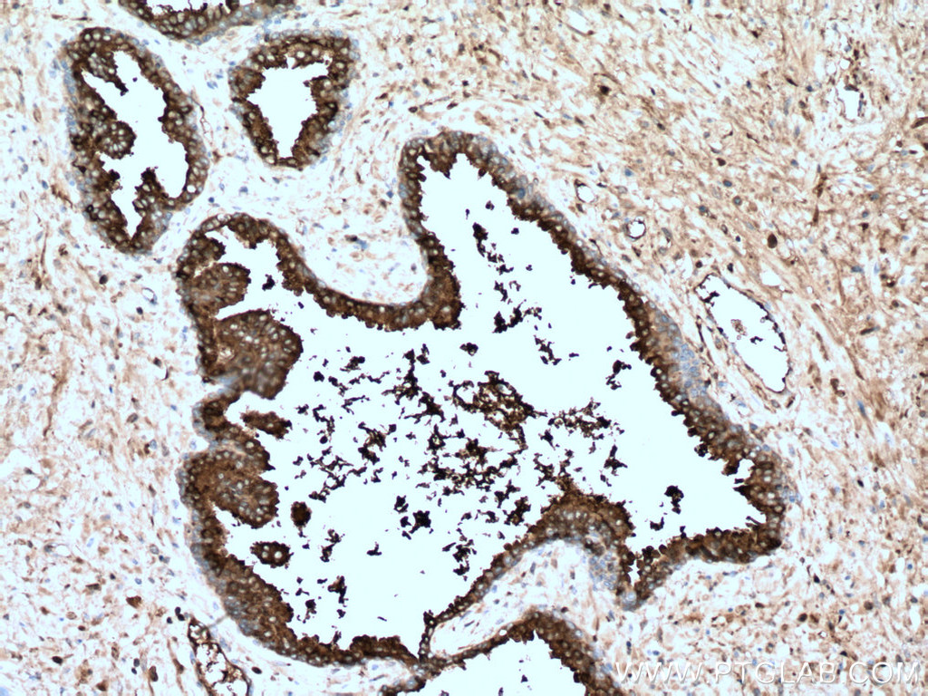KLK3/PSA Monoclonal antibody