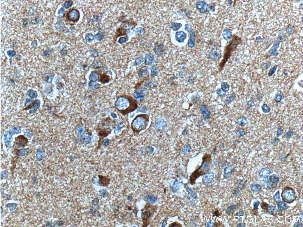 Beta Amyloid Monoclonal antibody