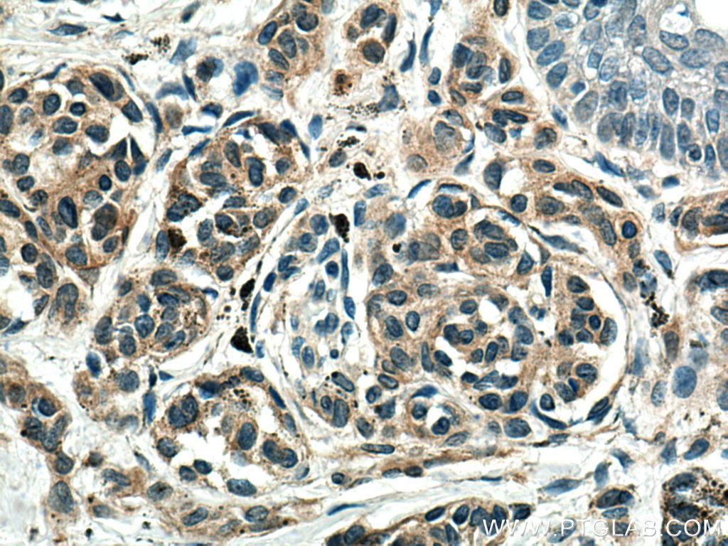 Melan-A  Monoclonal antibody