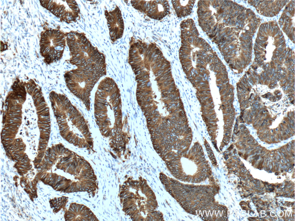 Cadherin-17 Monoclonal antibody