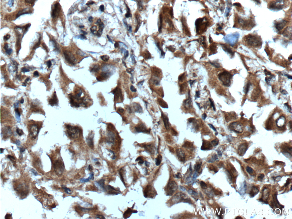 Inhibin beta A-Specific Monoclonal antibody
