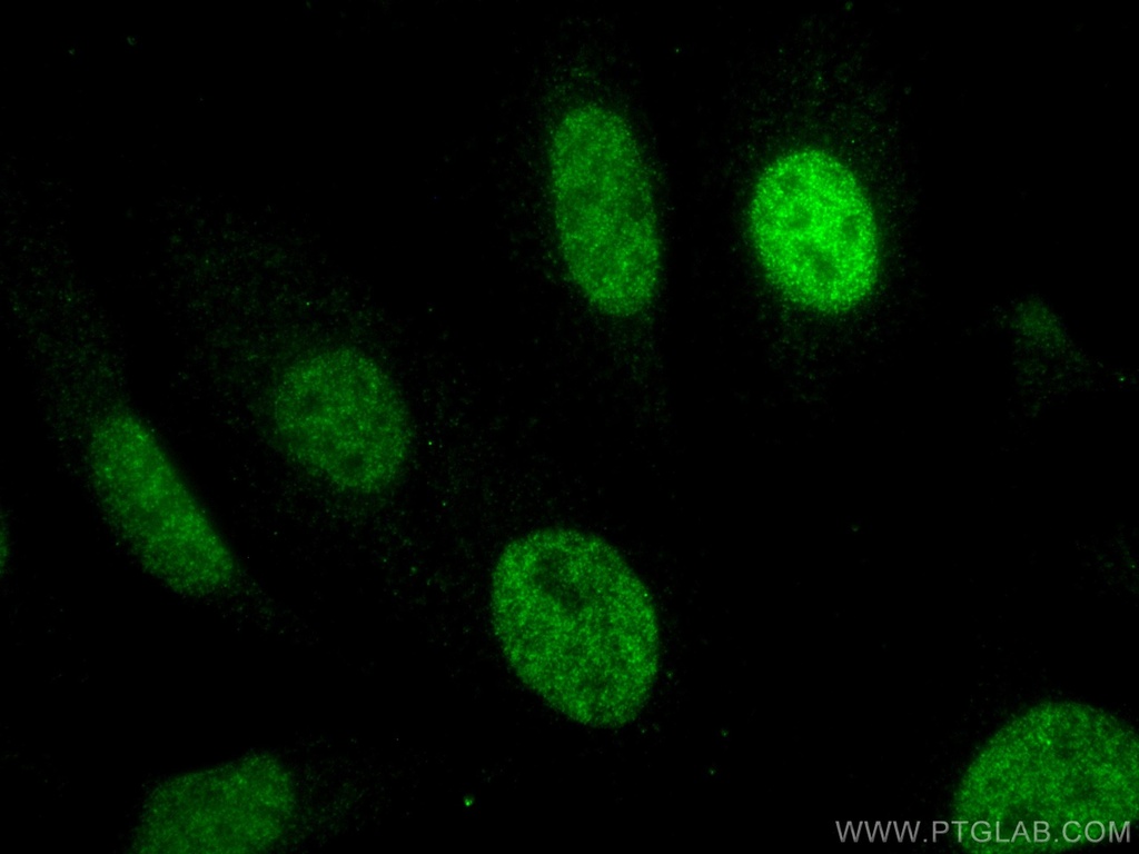 MUM1 Monoclonal antibody