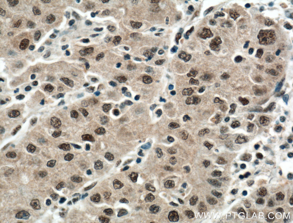 DDB1 Monoclonal antibody