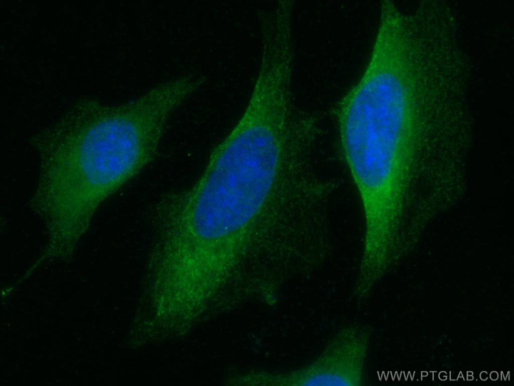 SEC5/EXOC2 Monoclonal antibody
