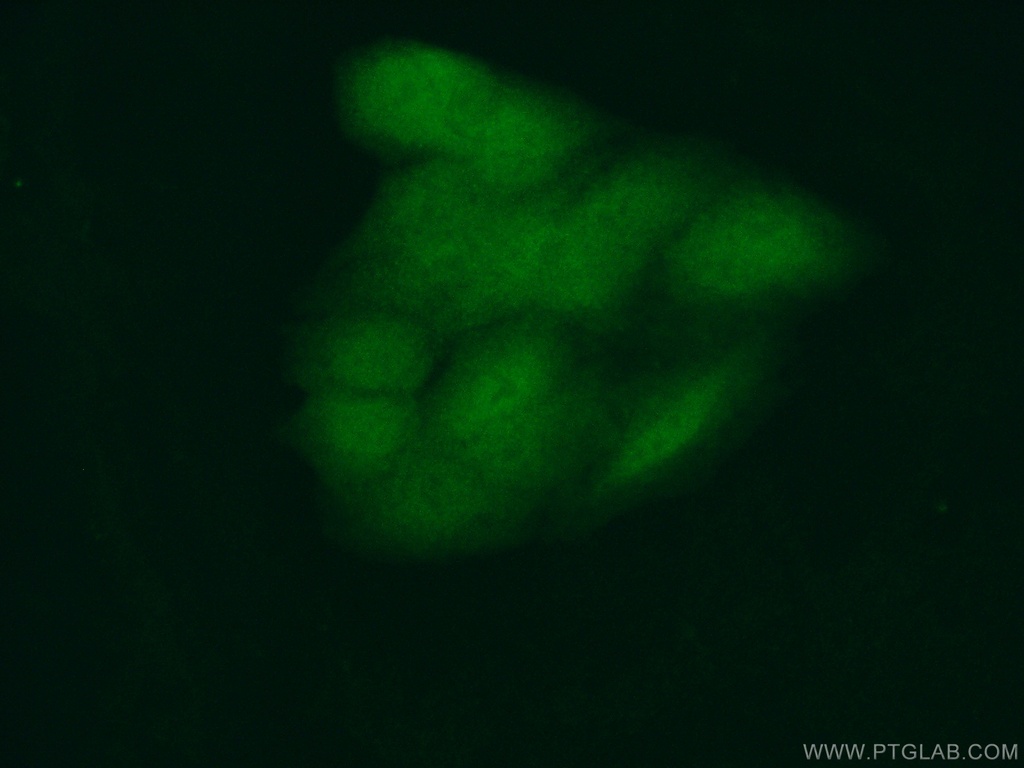 RBBP9 Monoclonal antibody