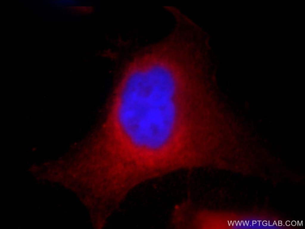 AHCY Monoclonal antibody