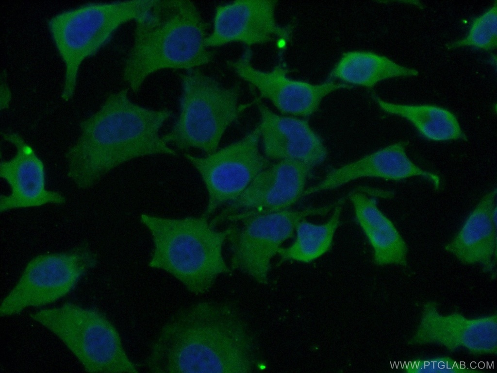 EIF3D Monoclonal antibody