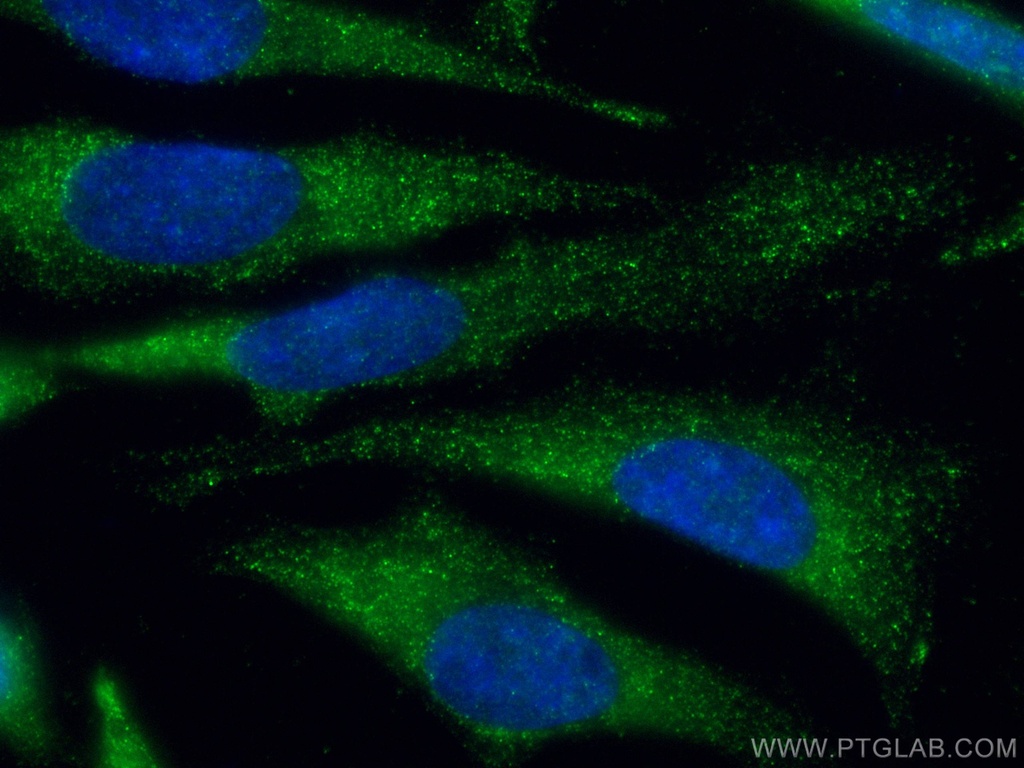 MCL1 Monoclonal antibody