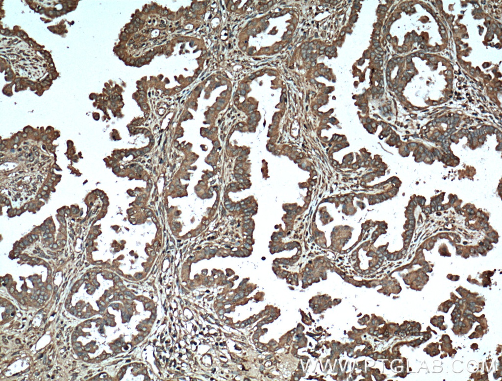 Protein C inhibitor Monoclonal antibody