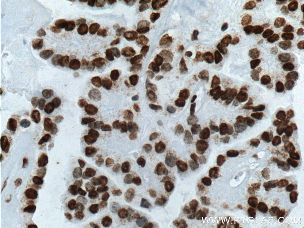 TTF1 Monoclonal antibody
