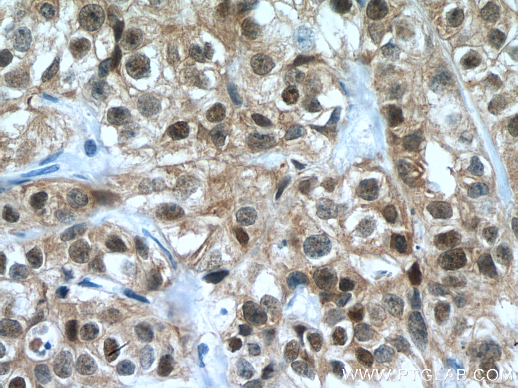FKBP52 Monoclonal antibody