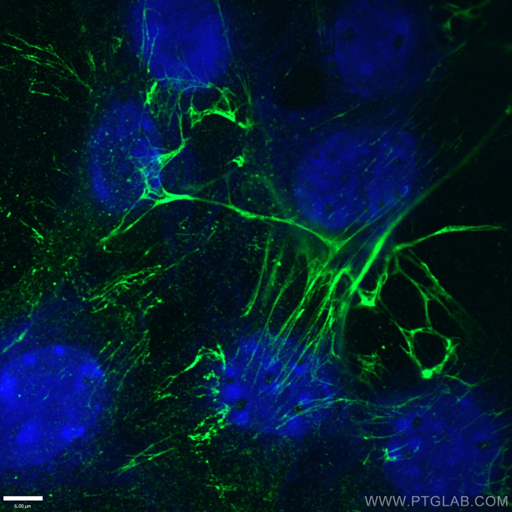 Fibronectin Monoclonal antibody