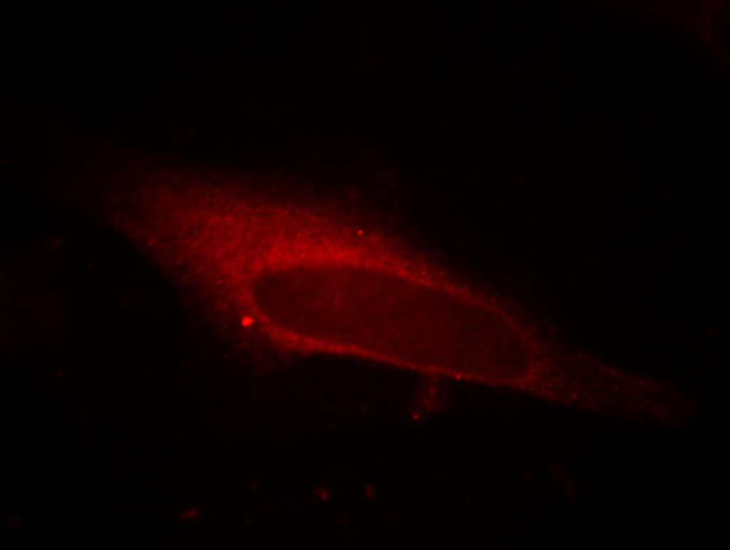 LPCAT1 Monoclonal antibody