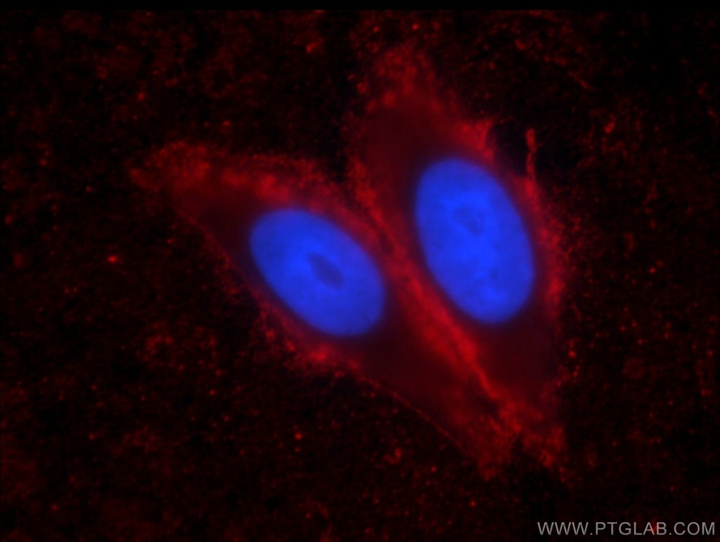 IA-2/PTPRN Monoclonal antibody