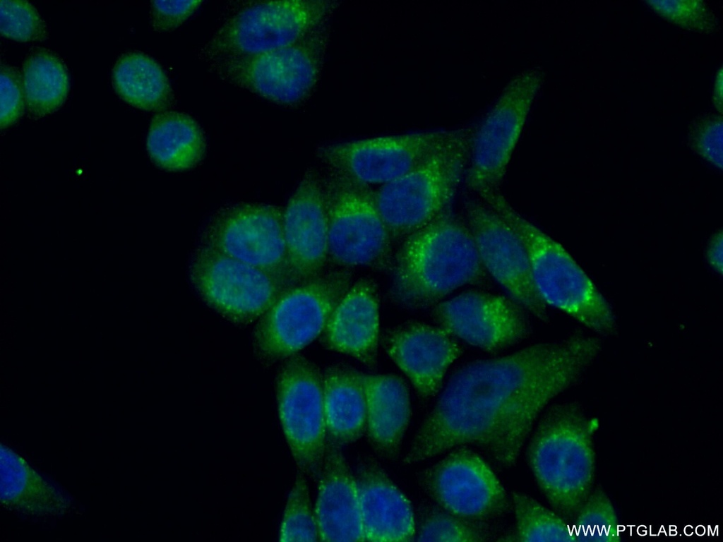 Cyclophilin B Monoclonal antibody