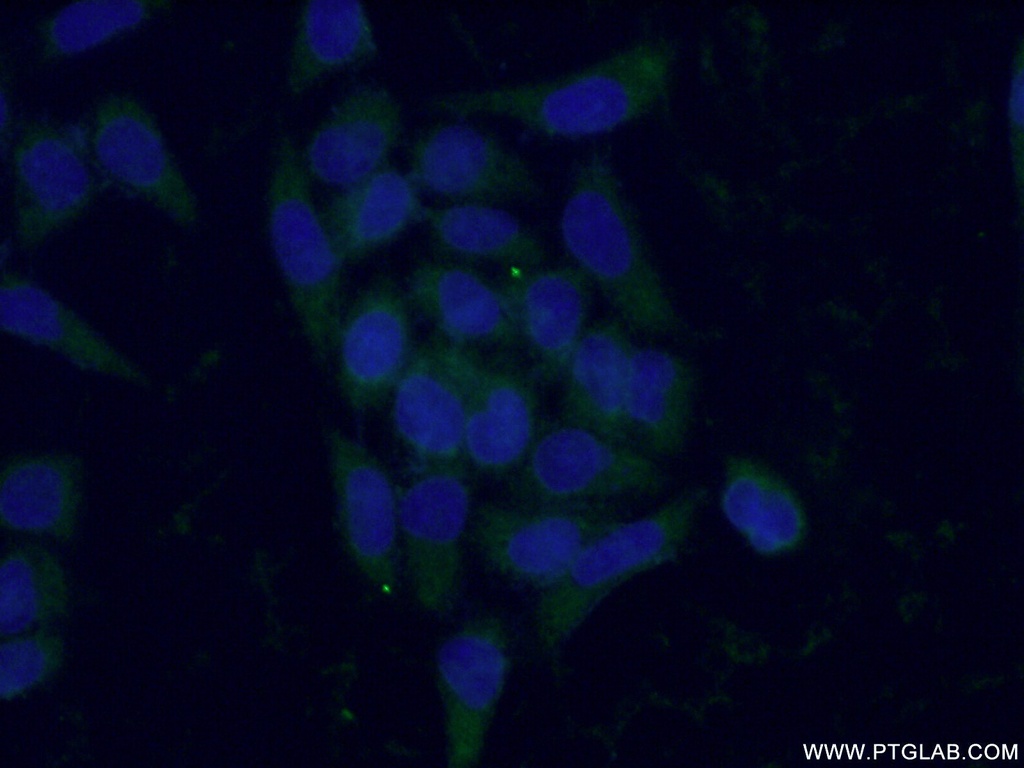 Antithrombin III Monoclonal antibody