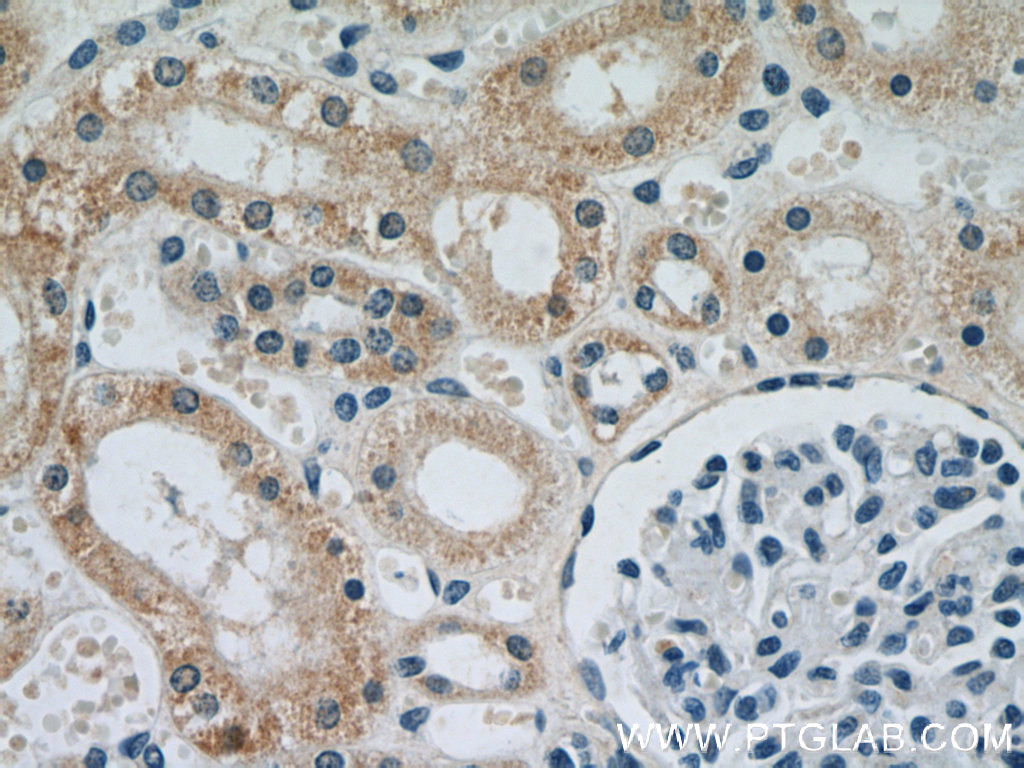 NDUFS5 Monoclonal antibody