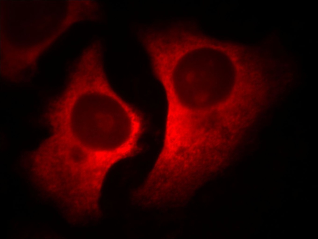 RACGAP1 Monoclonal antibody