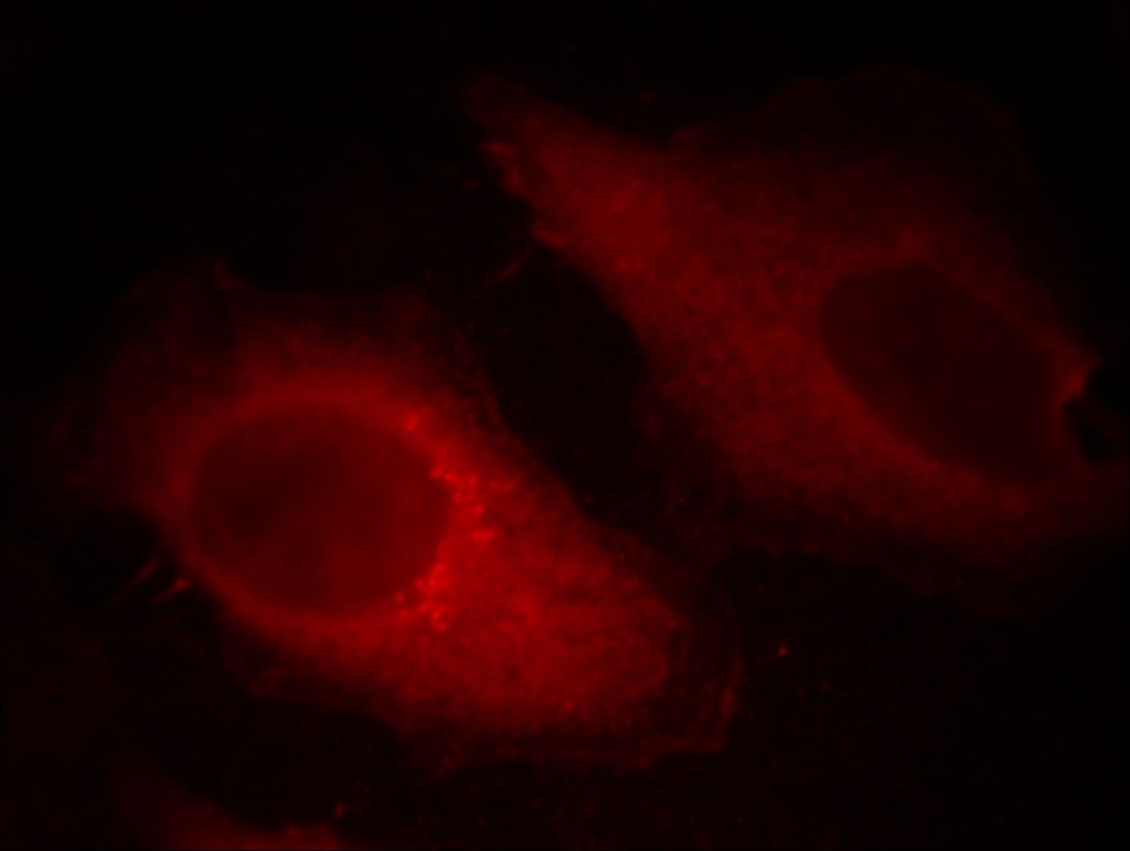 Cofilin Monoclonal antibody