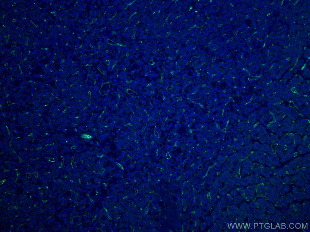 CD31 Monoclonal antibody