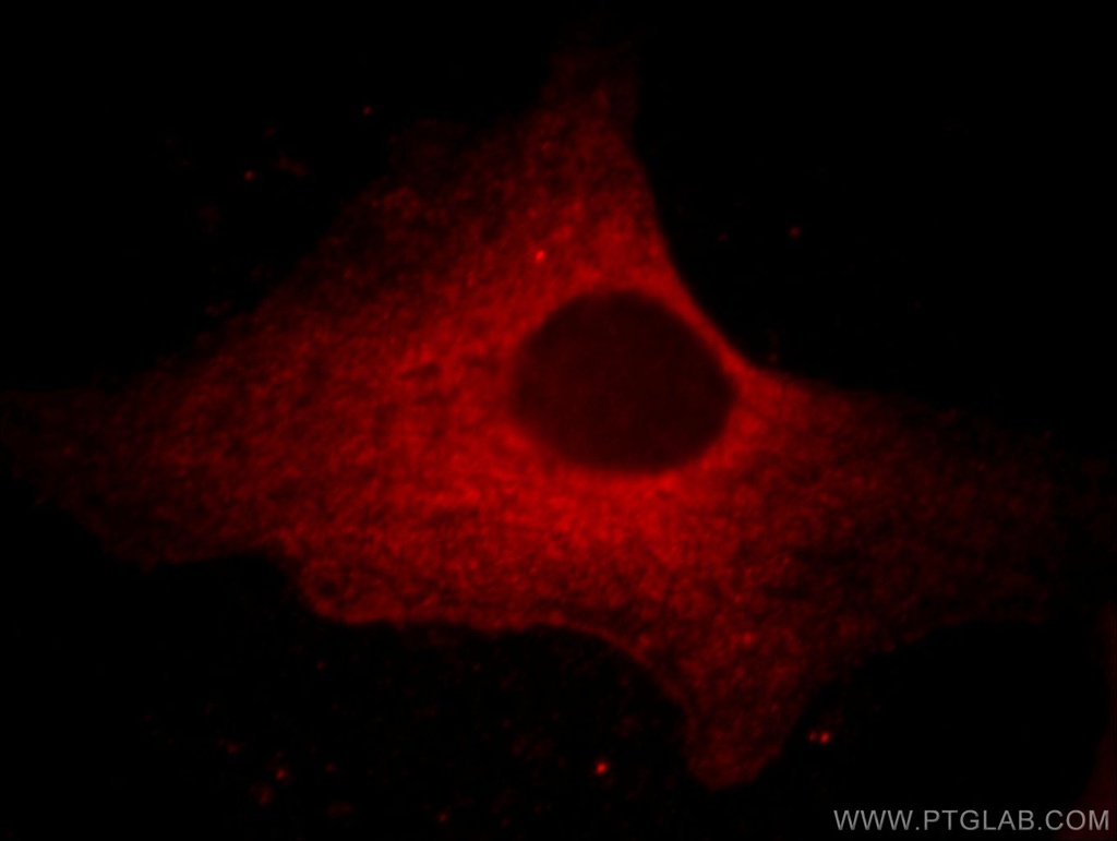 CAPZA1 Monoclonal antibody