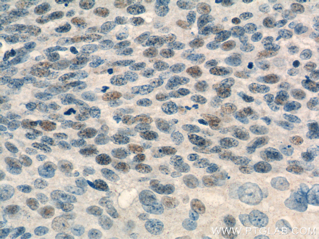USP1 Monoclonal antibody