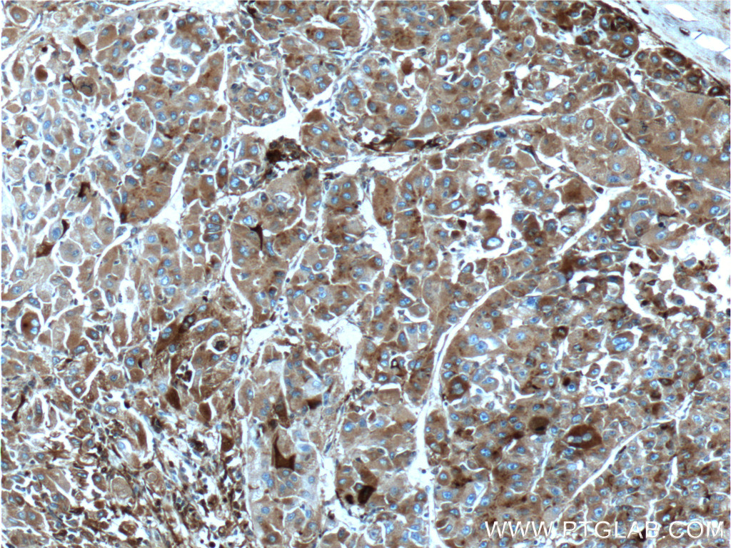 Apolipoprotein H Monoclonal antibody