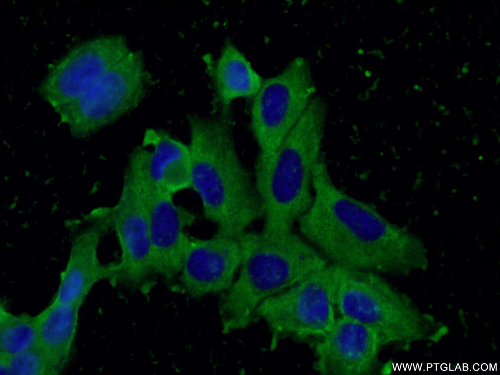 CISD2-Specific Monoclonal antibody