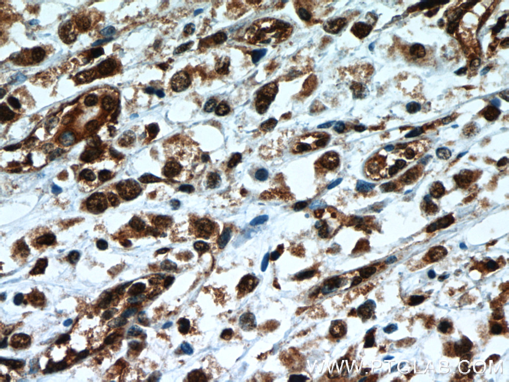 TLE3 Monoclonal antibody