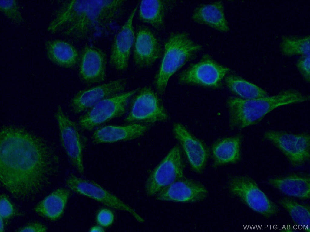 NCALD Monoclonal antibody