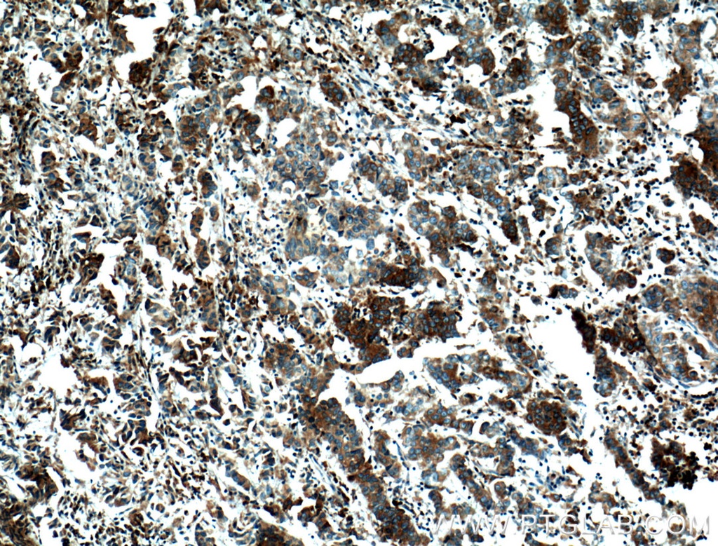 FKBP2 Monoclonal antibody