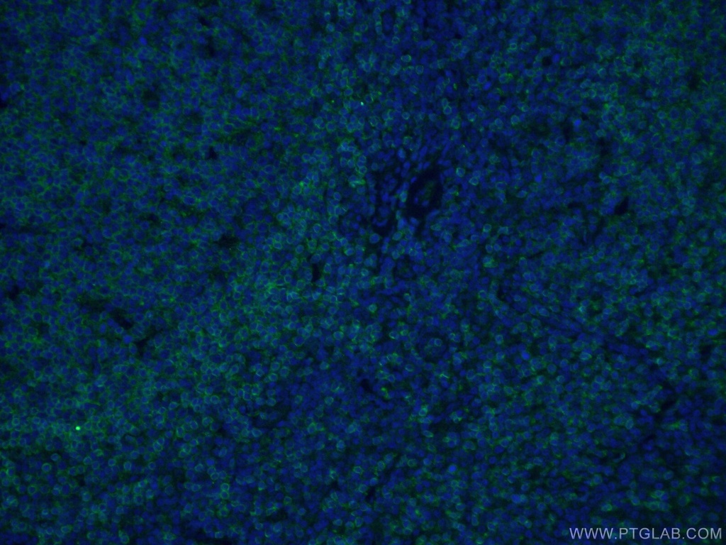 CD22 Monoclonal antibody