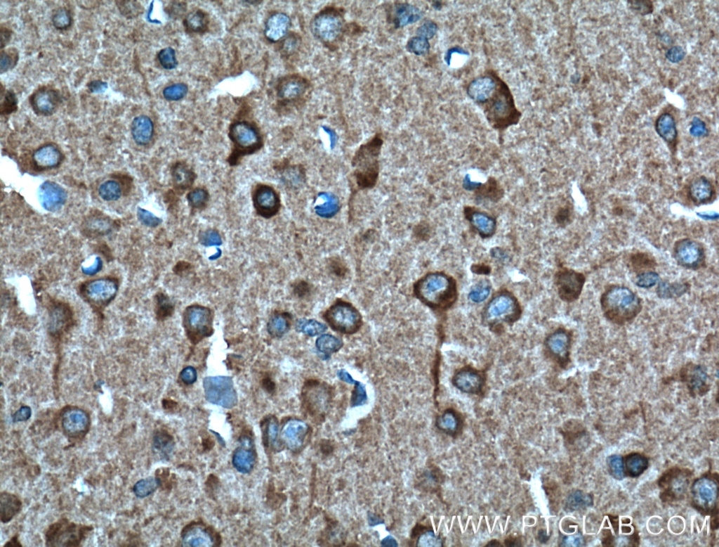 SULT4A1 Monoclonal antibody