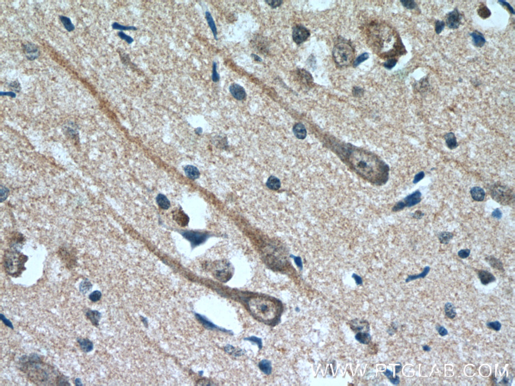 MAOB Monoclonal antibody