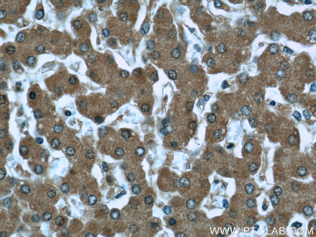 Prealbumin/transthyretin Monoclonal antibody