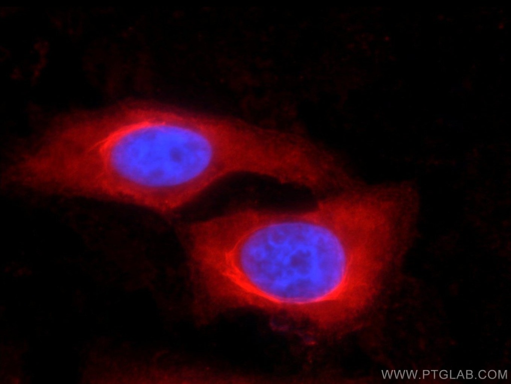 Iduronate 2 sulfatase Monoclonal antibody