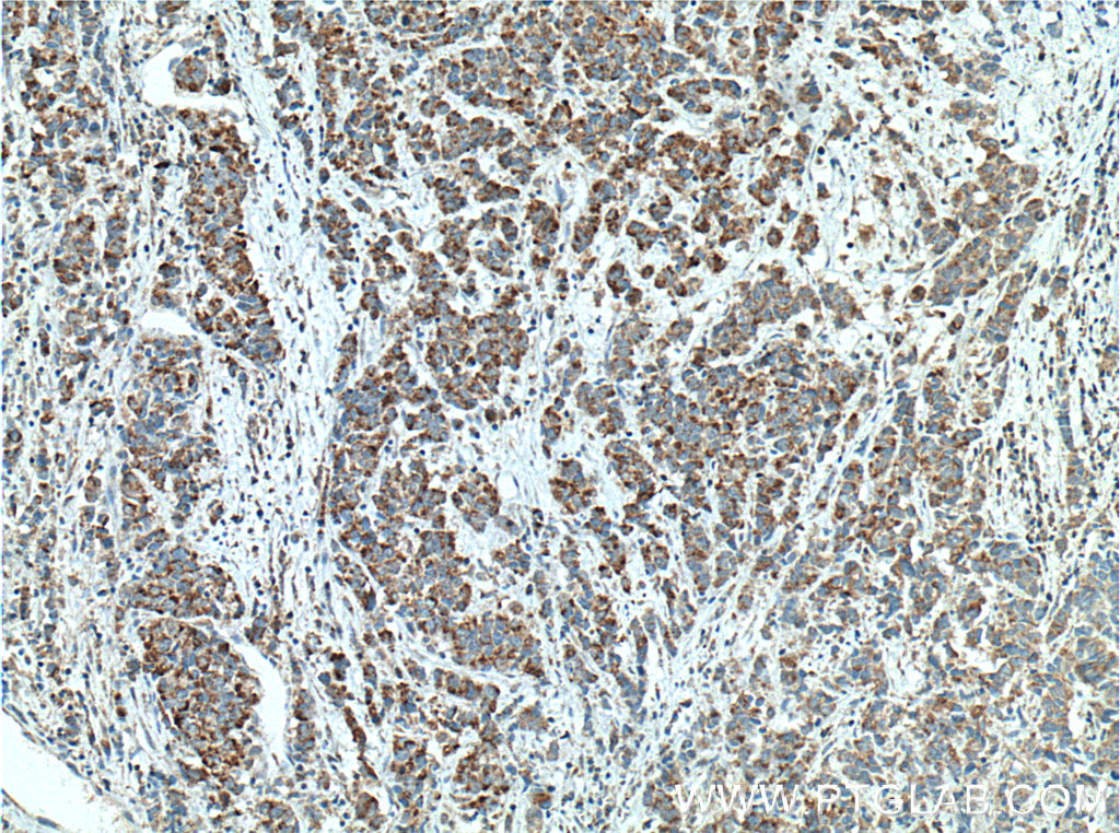 ECHS1 Monoclonal antibody