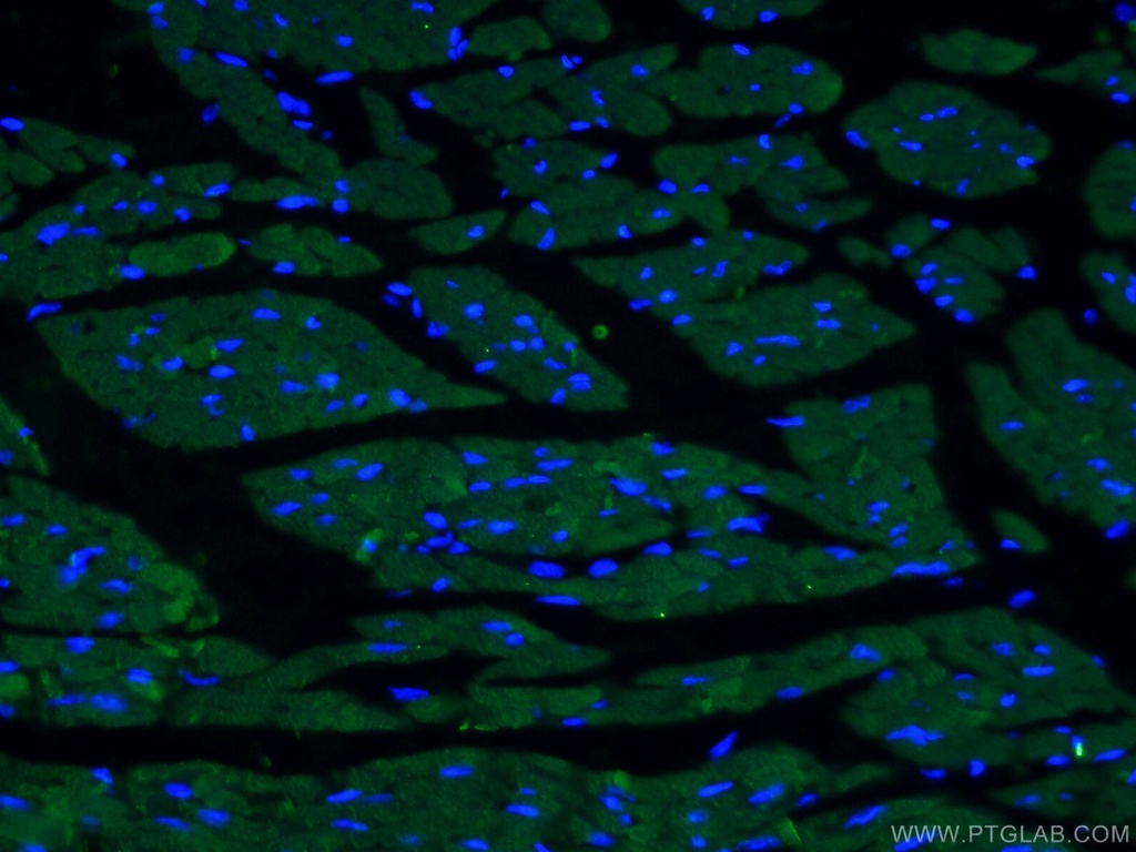 ACTC1-specific Monoclonal antibody