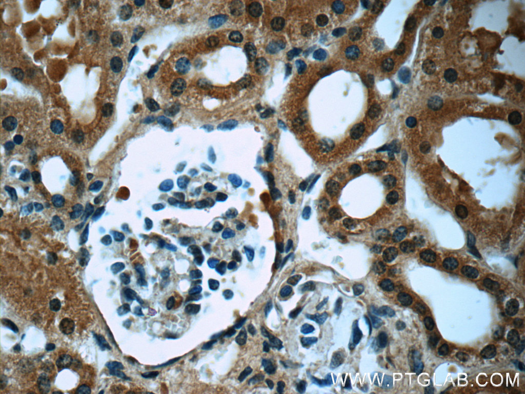 TRAPPC9,NIBP Monoclonal antibody