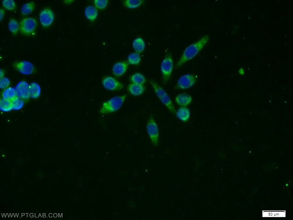 Amylase Alpha Monoclonal antibody